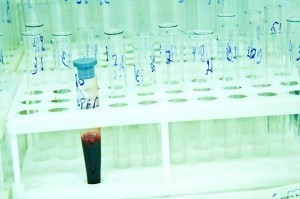 Blood test could predict heart attacks: US study