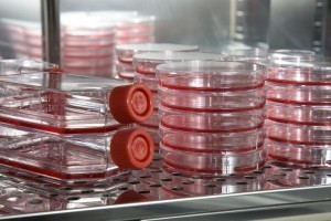 Chemotherapy can backfire and boost cancer growth: study