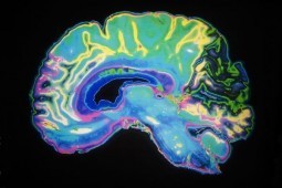 Japan-Canada study pinpoints brain’s addiction spots