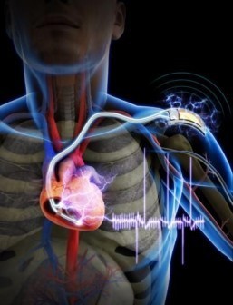 Self-powered cardiac pacemaker could spare seniors additional surgeries