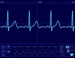 High doses of common pain drugs can cause heart attack: study