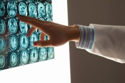 Brain scans help predict learning problems: study